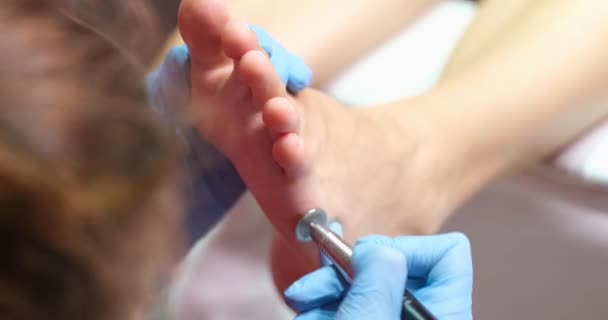Pedicure Master Removes Corns Womans Legs Close Cosmetic Procedure Salon — 图库视频影像