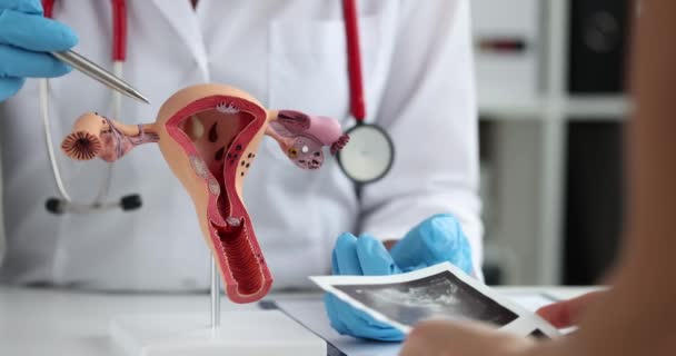 Клинике Гинеколог Демонстрирует Женщине Модель Женской Репродуктивной Системы Анатомия Женской — стоковое видео