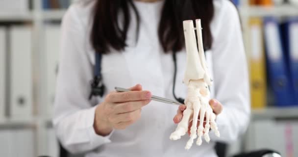Orthopedic Doctor Looks Fake Ankle Bone Anatomy Doctor Analyze Causes — Stok Video