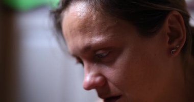 Tired exhausted stressed woman suffering from severe eye pain. Portrait of beautiful young sick woman in depression and fear