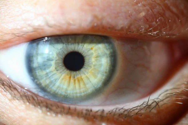 Closeup Human Eye Macro Photography Hyperopia Myopia Astigmatism Laser Vision — Foto de Stock