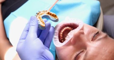Taking impressions for making dental veneers and woman in dental chair. Dentist holding impression for dental veneers in hands concept