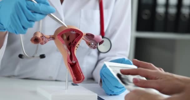 Doctor Shows Anatomical Model Uterus Pathologies Patient Gynecologist Showing Uterine — стоковое видео