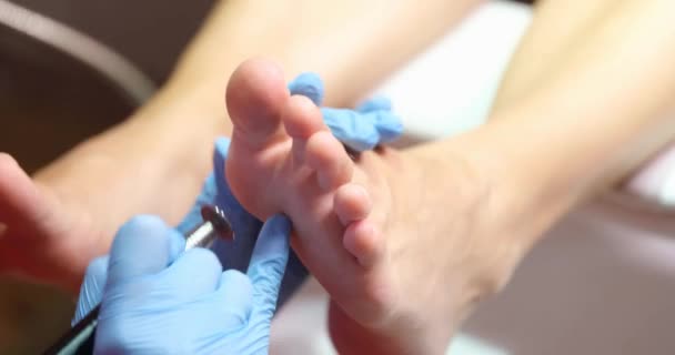 Mistrz Pedicure Rękawiczkach Zdejmuje Kukurydzę Stóp Zbliżenie Zabiegi Kosmetyczne Salonie — Wideo stockowe