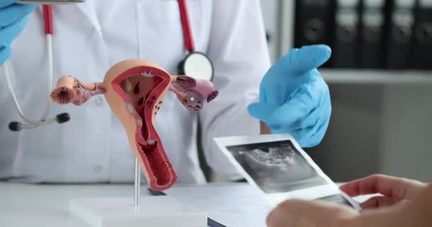 Doctor Explains Result Ultrasound Uterus Close Gynecologist Consultation Pregnancy Planning — Stock Video