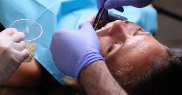 Οδοντίατρος Εγκαθιστά Οδοντοστοιχίες Γυναίκα Στην Κλινική Οδοντίατρος Προετοιμάζει Γυναικεία Δόντια — Αρχείο Βίντεο