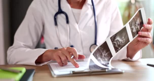 医師は子宮の超音波検査の結果を検査します 妊娠中や不妊中の医療超音波 — ストック動画