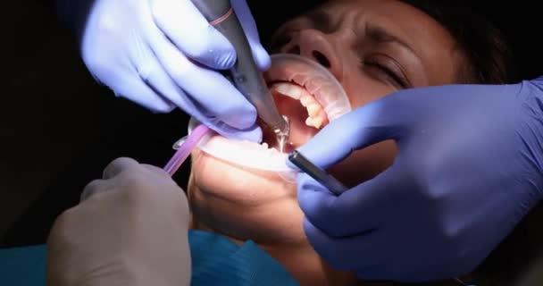 Пациентка Открытым Ртом Сверлит Дантиста Стоматологические Услуги Лечение Зубов — стоковое видео