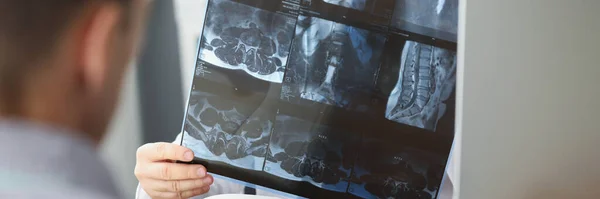 Κοντινό Πλάνο Του Γιατρού Εξέταση Ασθενείς Ακτινογραφία Αποτέλεσμα Στο Νοσοκομείο — Φωτογραφία Αρχείου