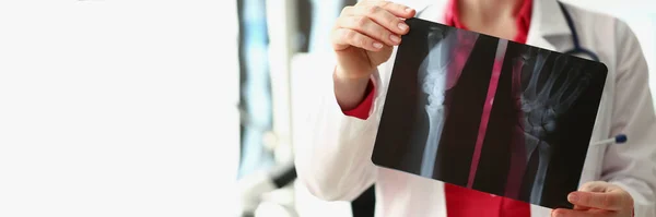 Close Van Medisch Medewerker Analyseren Patiënt Hand Röntgenfoto Resultaat Letsel — Stockfoto