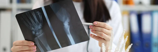 Medico Traumatologo Esamina Raggi Con Lesioni Braccio Diagnosi Trattamento Del — Foto Stock