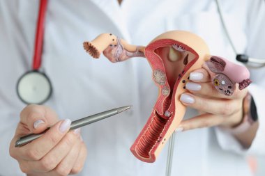Doktorlar kadın üreme organlarının bölümsel modelini yakın planda tutuyorlar. Jinekoloji ve doğum eğitimi.