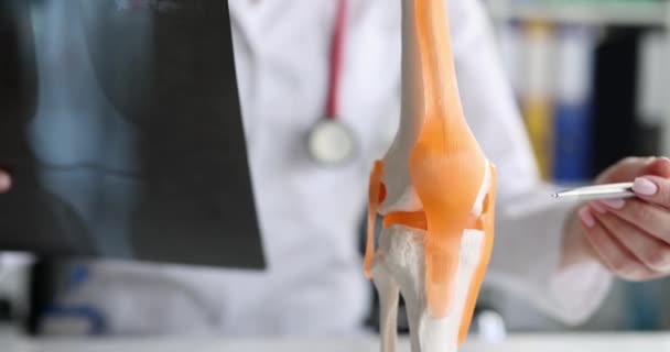 X線画像と脚の損傷リウマチの相談 骨格脚モックアップ医療の概念 — ストック動画