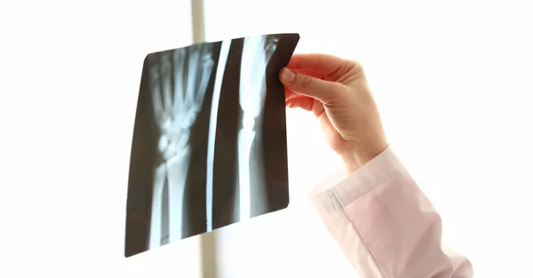 Ортопедичний Лікар Вивчає Зображення Рук Рентгенівському Знімку Біль Суглобах Концепції — стокове фото