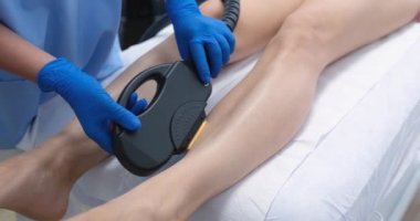 Beautician removes hair on beautiful female legs with laser. Epilation on legs and laser procedure in clinic