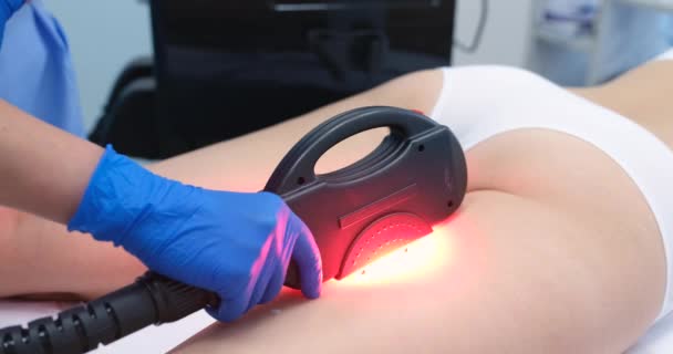 Elos Laserowa Depilacja Nóg Salonie Piękności Zabieg Depilacji Kosmetycznej Klinice — Wideo stockowe