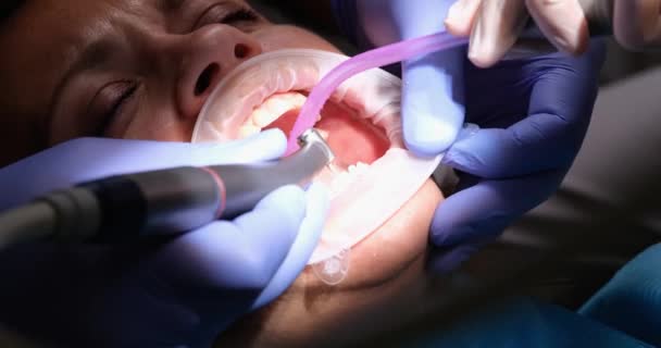 牙科医生用唾液喷射器收集妇女口中的唾液 并切断牙齿牙釉质 陶瓷贴面和牙冠的制作 — 图库视频影像