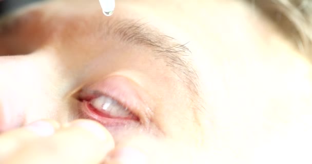 Kontakt Lenslerden Sonra Göz Damlası Damlar Göz Korneasını Nemlendirir Görme — Stok video