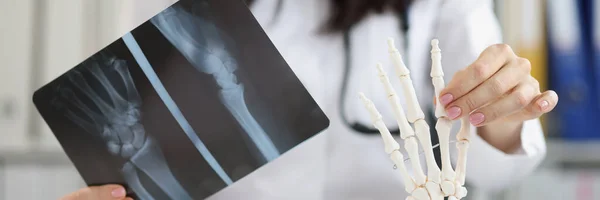 Radiographie Main Dans Les Mains Médecin Gros Plan Floue Squelette — Photo