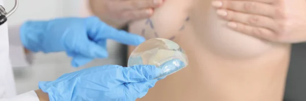 Lékařská Ruka Drží Silikonový Prsní Implantát Poblíž Nahé Pacientky Velikost — Stock fotografie