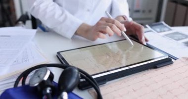 Kardiyolog kalp ağrısı olan hastanın elektrokardiyogramını inceliyor. İskemik kalp hastalığı konsepti