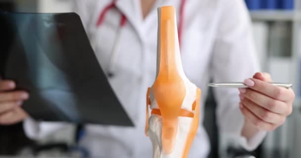 医師は変形性関節症やモックレッグの関節症と脚のX線を保持しています 関節の脱臼の診断 関節炎や足首関節疾患の検出のためのヒト診断装置 — ストック動画
