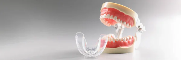 Κοντινό Πλάνο Του Ανθρώπινου Μοντέλου Δοντιών Ορθοδοντικό Οδοντικό Μοντέλο Δοντιών — Φωτογραφία Αρχείου