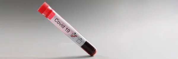 Close-up of test tube with coronavirus positive blood result on grey background. New coronavirus infection, virus spread. Medicine, healthcare, ill concept