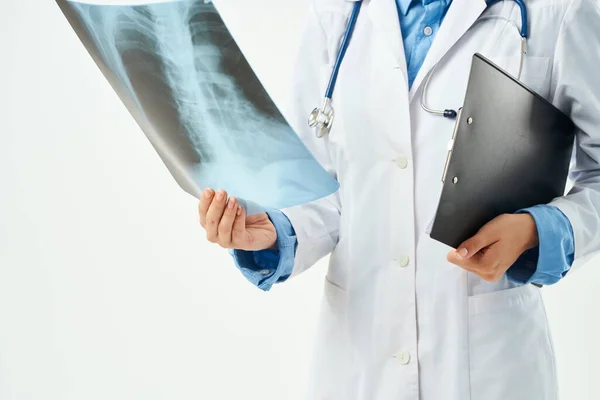 Лікар у білому пальто рентгенівські промені дослідницької роботи легенів — стокове фото