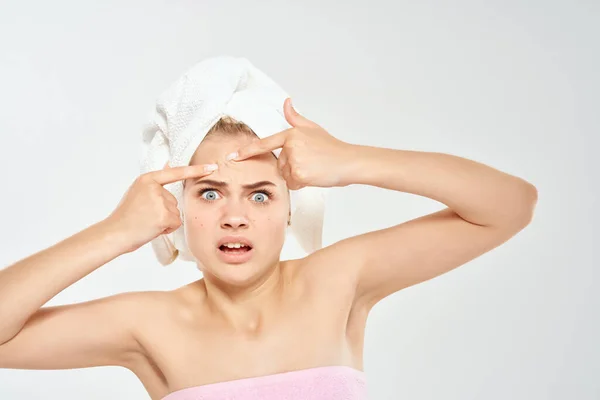Красивая женщина с полотенцем на голове проблемы кожи лица дерматология — стоковое фото