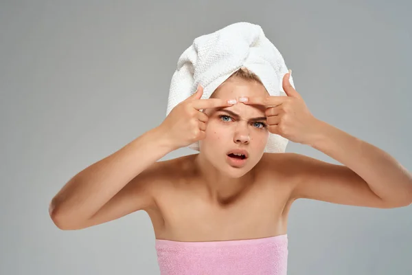 Mooie vrouw met een handdoek op mijn hoofd gezichtsproblemen dermatologie — Stockfoto