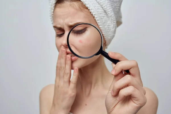 Hermosa Mujer Con Grano Cara — Foto de Stock