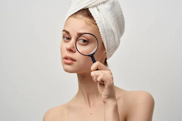Mooie vrouw met een handdoek op mijn hoofd huidproblemen close-up — Stockfoto
