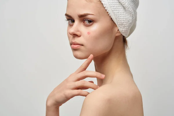 Beautiful woman with a towel on my head dermatology isolated background — Stock Photo, Image