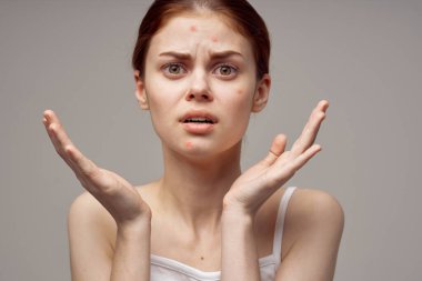 Kızıl saçlı kadın yüz derisi sorunları yakın plan dermatoloji