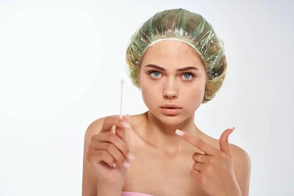 Vrouw blote schouders acne behandeling dermatologie — Stockfoto