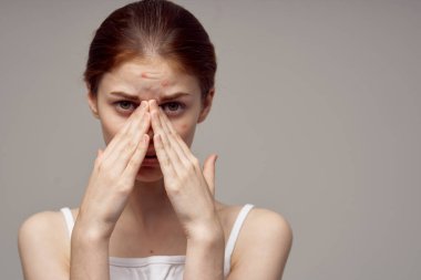 Yüzünde sivilceleri olan kızıl saçlı kadın. Hijyen arkaplan.