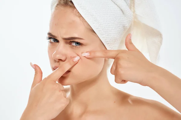 Mujer hombros desnudos acné tratamiento higiene fondo claro — Foto de Stock