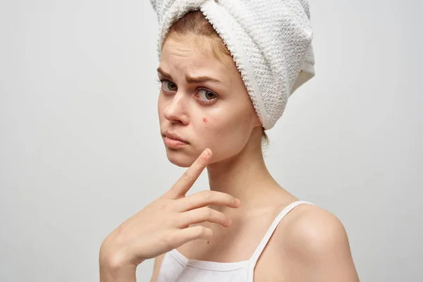 Mulher com uma toalha na minha cabeça problemas de pele close-up — Fotografia de Stock