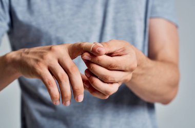 Sakallı adam bandajlı parmak tedavisi görüyor.