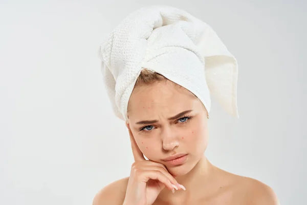 Vacker kvinna bar axlar akne behandling dermatologi — Stockfoto