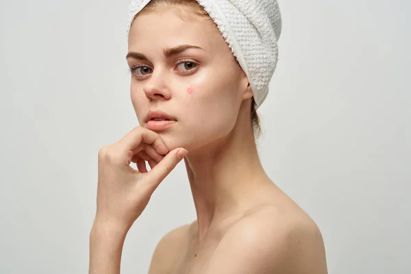 Bela mulher com uma espinha no rosto cosmetologia Studio — Fotografia de Stock