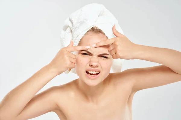 Mujer bonita hombros desnudos tratamiento del acné Estudio de cerca — Foto de Stock