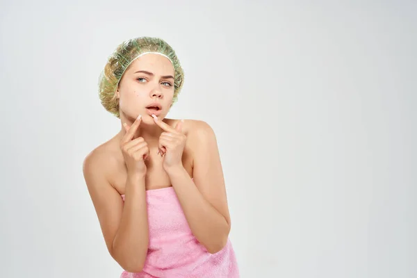 Bella donna doccia berretto acne sul viso Studio — Foto Stock