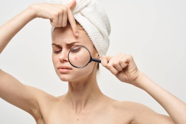 Yüzünde sivilce olan güzel bir kadın.