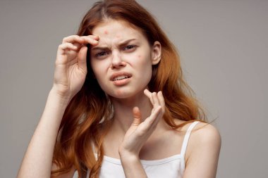 Cilt sorunu olan güzel bir kadın. Dermatolojiye yakın çekim. Yüksek kalite fotoğraf