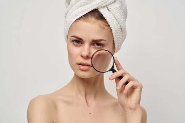 Красива жінка з рушником на голові проблеми зі шкірою крупним планом — стокове фото