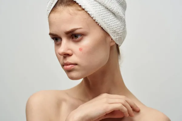 Mooie vrouw met een handdoek op mijn hoofd dermatologie geïsoleerde achtergrond — Stockfoto