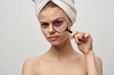 Yüzünde sivilce olan güzel bir kadın.