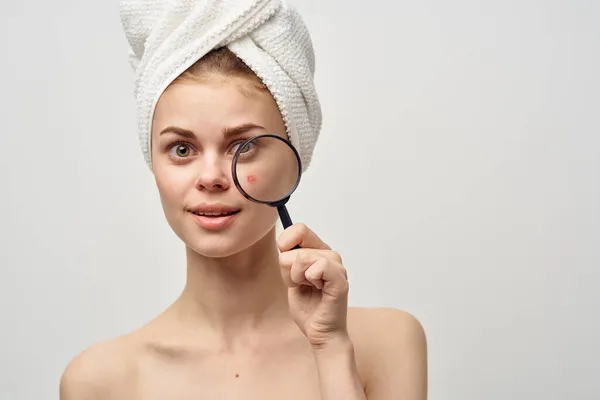 Mulher com uma espinha no rosto dermatologia fundo isolado — Fotografia de Stock